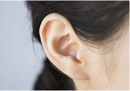 耳ツボ診療